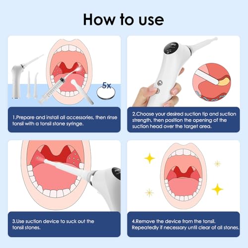 Tonsil Stone Remover Set, 65 kpa Electric Almond Stones Removal | 3-speed suction, with LED light and 5x magnifying glass, for healthy almonds and fresh breath White