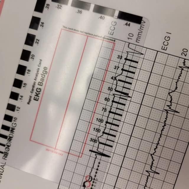 [Australia - AusPower] - EKG PVC Badge Card – Accurately Interpret ECG/EKG Rhythm Strips and 12 Lead EKG Without EKG Calipers – for Nurse NHS or Anyone in Healthcare! 