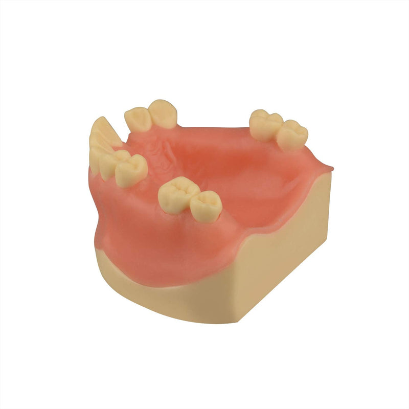 [Australia - AusPower] - Maxillary Dental Implant Model Missing Partial Teeth, Basic Implant Training Model with Practice Soft Gums, Great Dental Training Tooth for Dental Implant Practice 