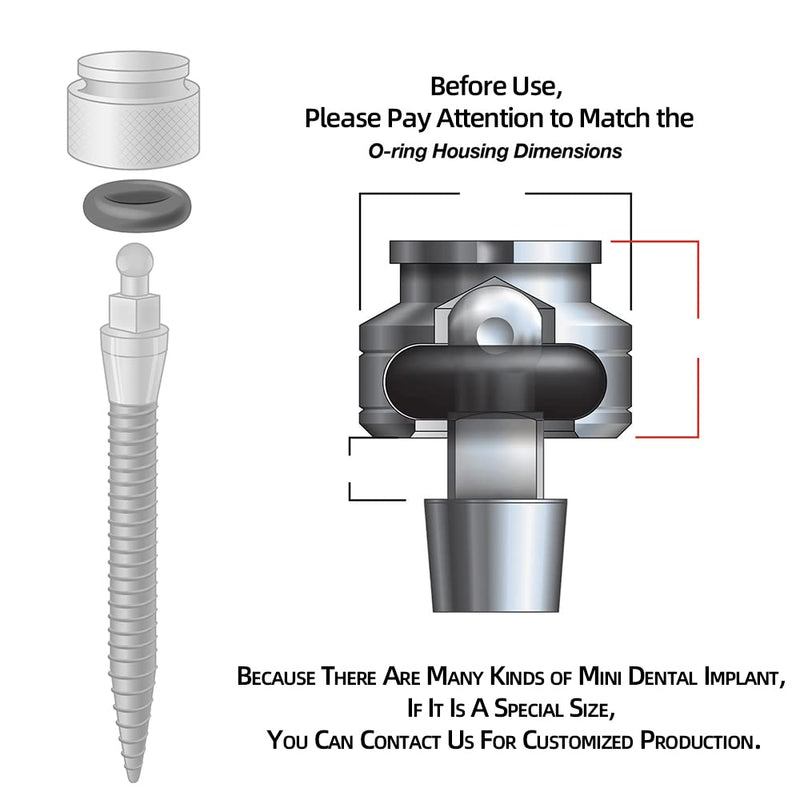 [Australia - AusPower] - O-Ring, Buna-n, Tool Kit with 3 Convenient Sizes, Replacement for Mini Dental Implants 