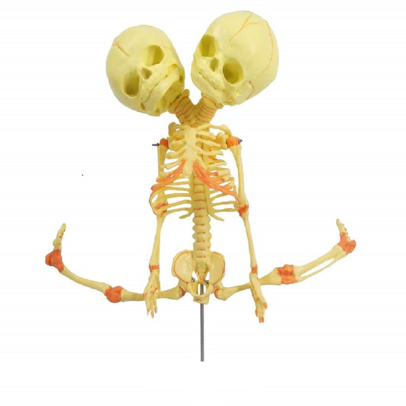 EVOTECH SCIENTIFIC Human Infant Skeleton Model, Twin-Skull, Human Fetus Skeleton W/Double-Skull Model for Medical Study Teaching Display