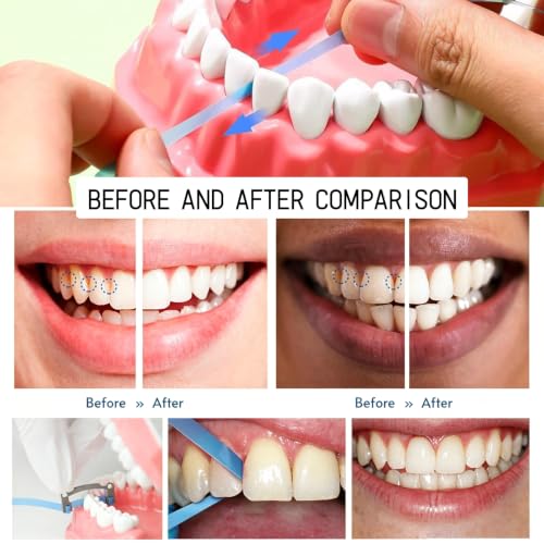 Pack of 60 Teeth Sandpaper for Spaces, Tooth Sandpaper 15 x 4.5 cm, Dental Sanding Strips Polishing Strips Teeth Polishing Finishing Gloss Contouring Tool Kit for Deep Cleaning of Teeth