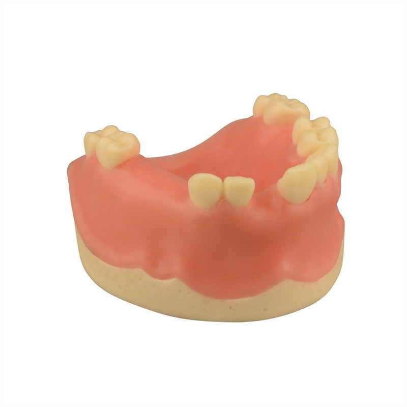 [Australia - AusPower] - Maxillary Dental Implant Model Missing Partial Teeth, Basic Implant Training Model with Practice Soft Gums, Great Dental Training Tooth for Dental Implant Practice 