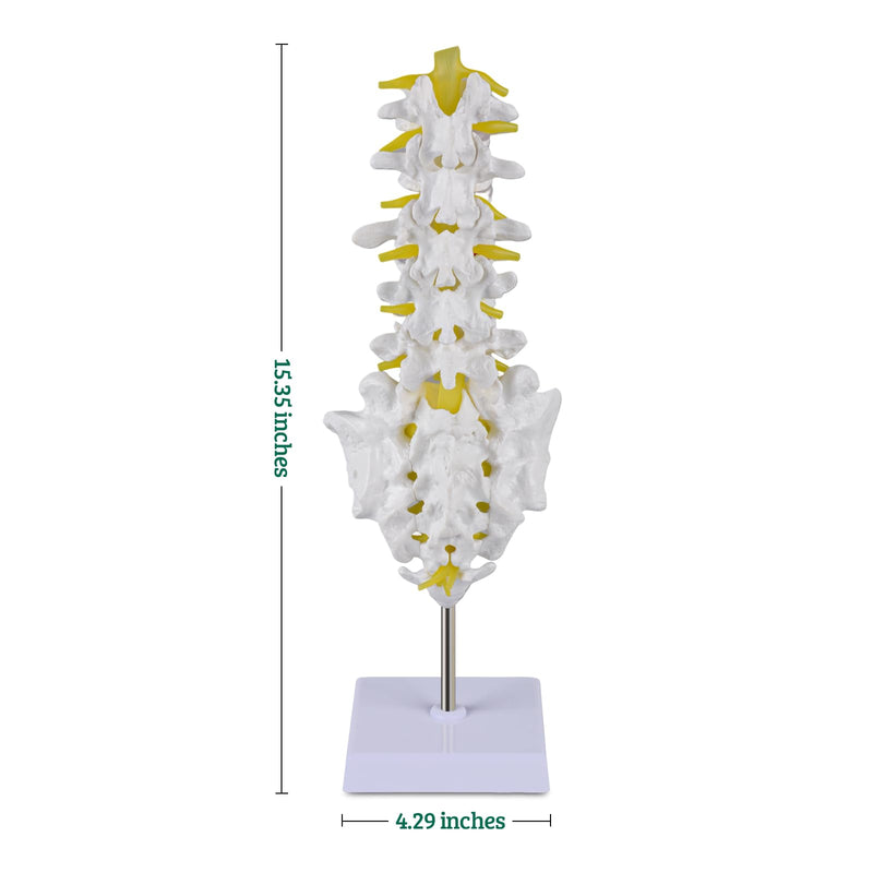 Ultrassist Human Lumbar Spine Model, Lumbar Vertebrae Anatomy Model with Herniation Discs, Lumbar Nerves and Spinal Cord for Medical Student Study Teaching