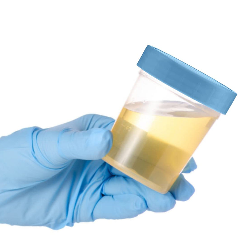 [Australia - AusPower] - Specimen Cups with Leak Proof Screw on Lids - 4oz [Pack of 25] Clear Non-Sterile Urine Sample Jars - Containers for Safe Pee, Stool, Semen Sample Collection for Testing (25) 