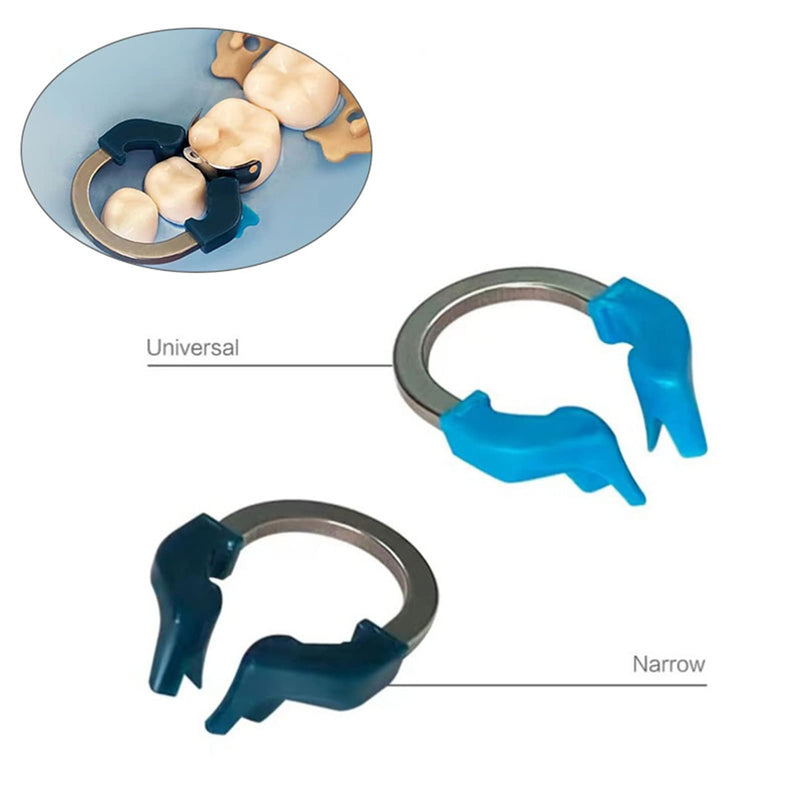 [Australia - AusPower] - Dental Sectional Matrix System, Dental Sectional Contoured Matrices Refill Matrix Bands, Sectional Contoured Metal Matrices, Nickel Titanium Clamp Ring Resin Holder Clip Ring-BLUE BLUE RING 