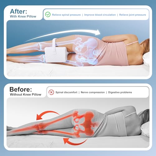 UJPFEO Knee Pillow for Side Sleepers,Memory Foam Leg Support Pillow for Sleeping Comfort,Knee Cushion for Hip,Knee,Back and Sciatica Relief,Helps Align Spine,White,with Strap White
