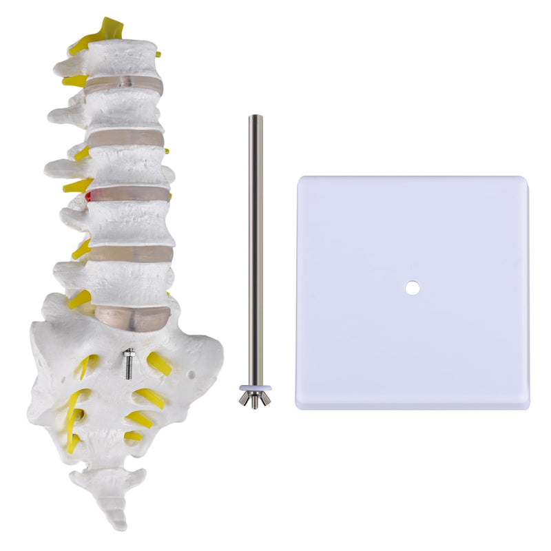 Ultrassist Human Lumbar Spine Model, Lumbar Vertebrae Anatomy Model with Herniation Discs, Lumbar Nerves and Spinal Cord for Medical Student Study Teaching