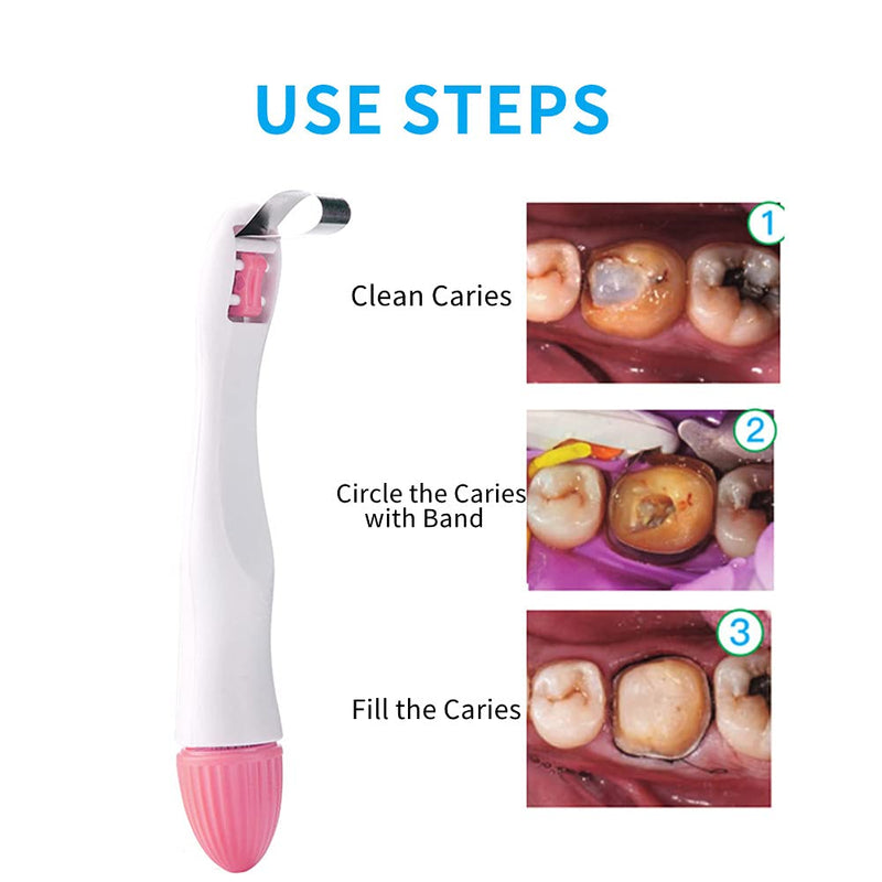 [Australia - AusPower] - Dental Matrix Band, 50pcs Momar Restoration Matrix-Profecto Sectional Matrix Ring System Adjust (4.5MM-Curved) 4.5MM-Curved 