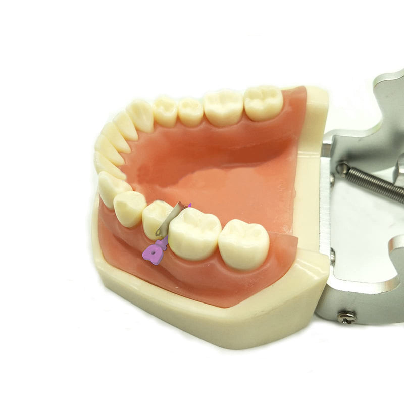 [Australia - AusPower] - Angzhili 40 Pcs/Box Dental Wedge Knife Teeth Interproximal Plastic Wedge (Orange) Orange 