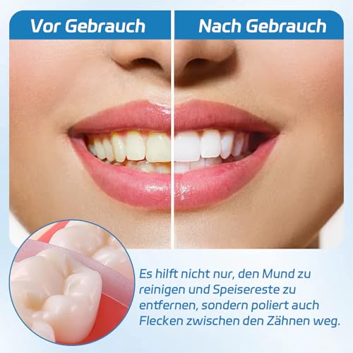 Tooth Sandpaper, Cleaning Polishing Strips, 4 Volumes | Interdental Sandpaper Travel Friendly Sanding Strips for Tartar Removal and Tooth Repair