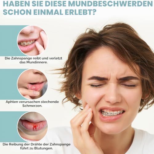 InhwRior Orthodontic Wax Pre-Cut for Easy Use Scientific Dosage Each Piece Covers Braces Braces Quickly Relieves Braces Discomfort (4) 4