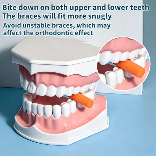 Aligner Seater, Pack of 10 Aligner Trays, Aligner Chewies, Reusable Aligner Chompers, Washable with Handle for Braces, Invisible Braces Bites (5 Colours)