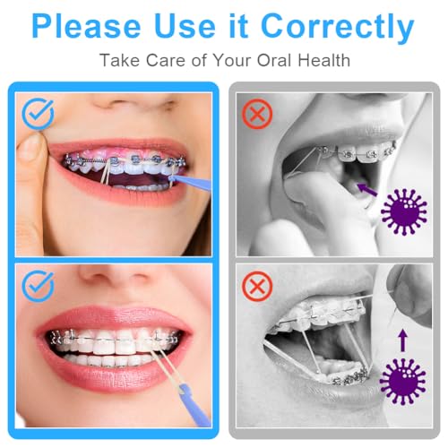 OFFCUP Orthodontic Elastic Teeth, Pack of 500 | Orthodontic Elastics with 5 Braces Placer for Gap Braces, Braces, Crooked (Rabbit 3/16") 3/16''