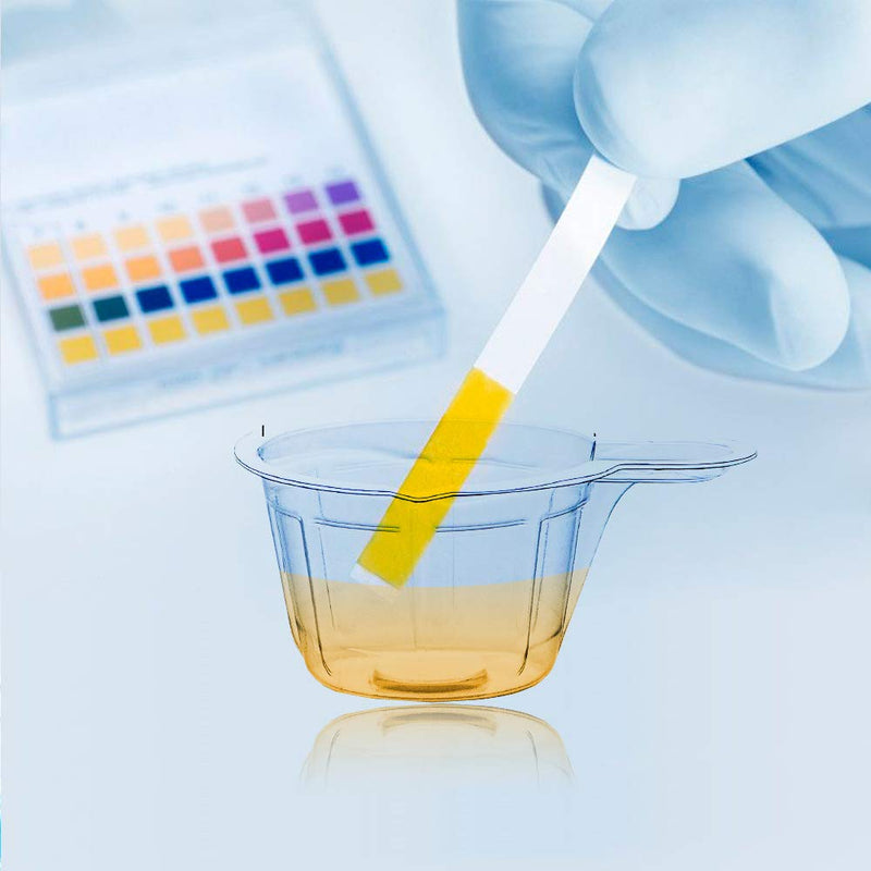 [Australia - AusPower] - 40ml Plastic Disposable Urine Cups - 80/120/200 pcs Easy to Collect Urine Specimen Cups for Pregnancy Test/Ovulation Test/pH Test (80) 