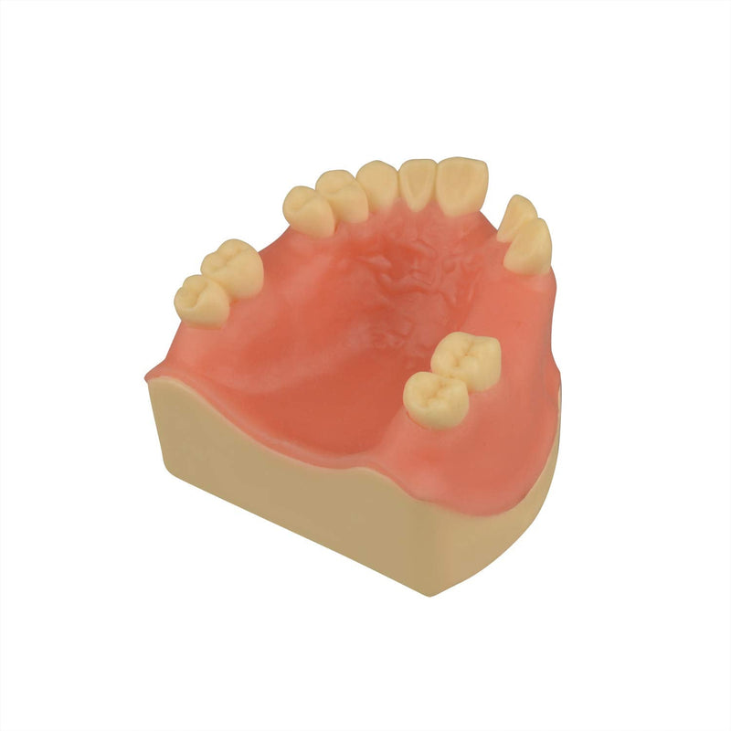 [Australia - AusPower] - Maxillary Dental Implant Model Missing Partial Teeth, Basic Implant Training Model with Practice Soft Gums, Great Dental Training Tooth for Dental Implant Practice 