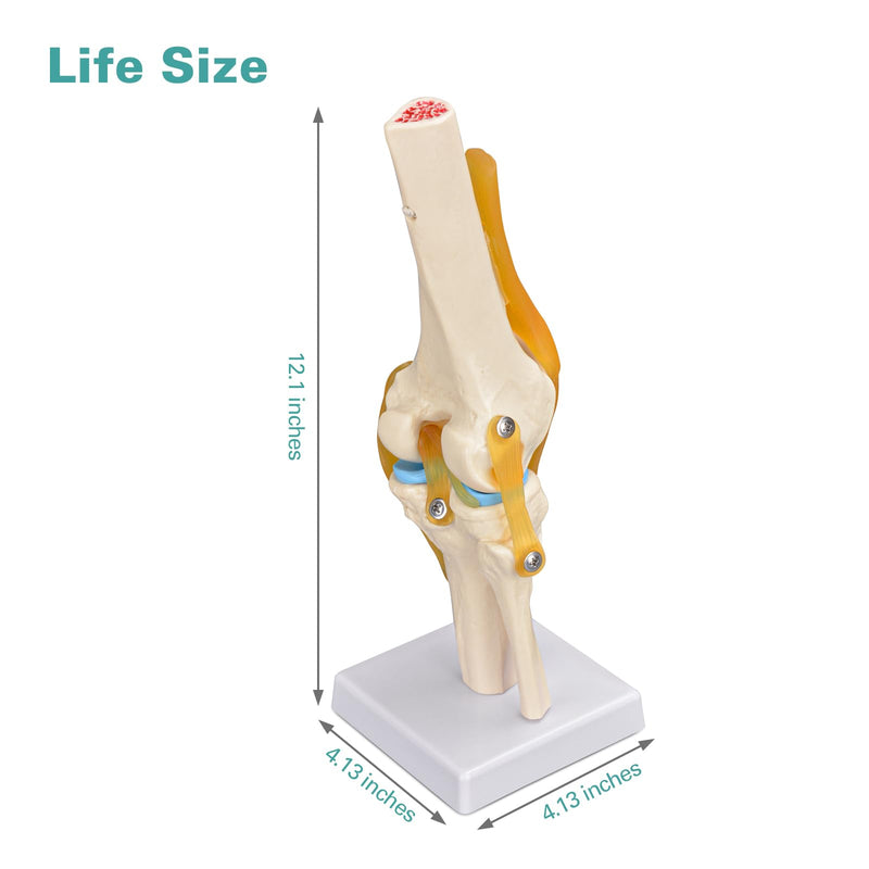 Human Knee Joint Model, 1:1 Scientific Life Size Anatomy Model with Ligaments, Anatomical Teaching Tool for Patient Education and Study