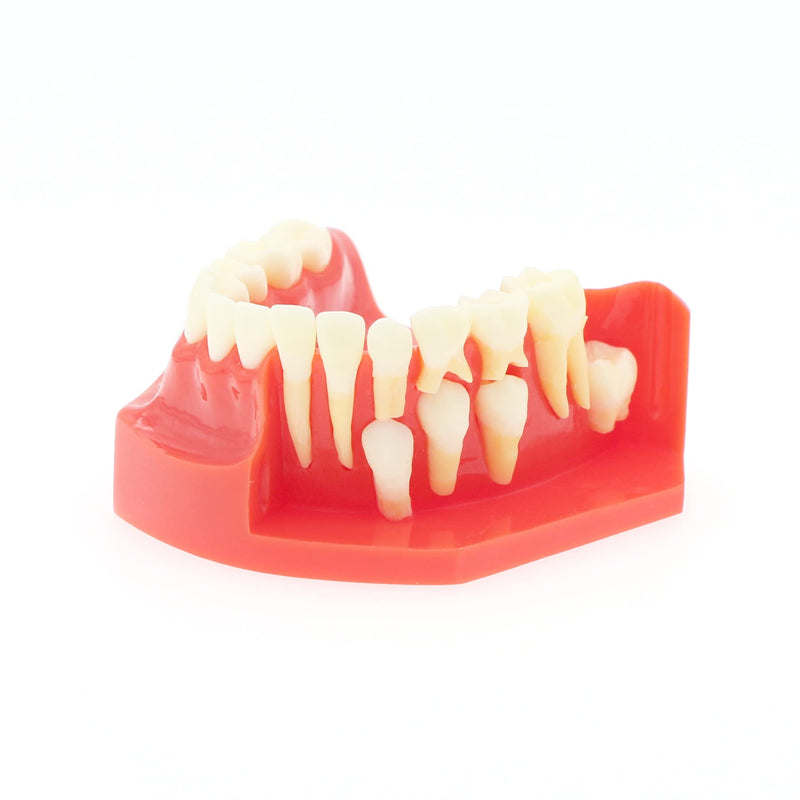 [Australia - AusPower] - Teeth Typodonts Dental Model #7013 - Teeth Eruption Development Model Alternating Model of Constant Pressure of Deciduous Teeth 
