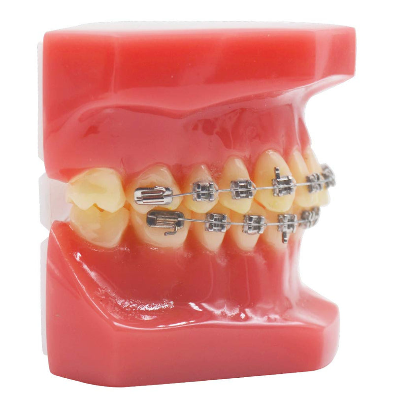 Dental Orthodontic Metal Brcket with Typodont Teeth Model