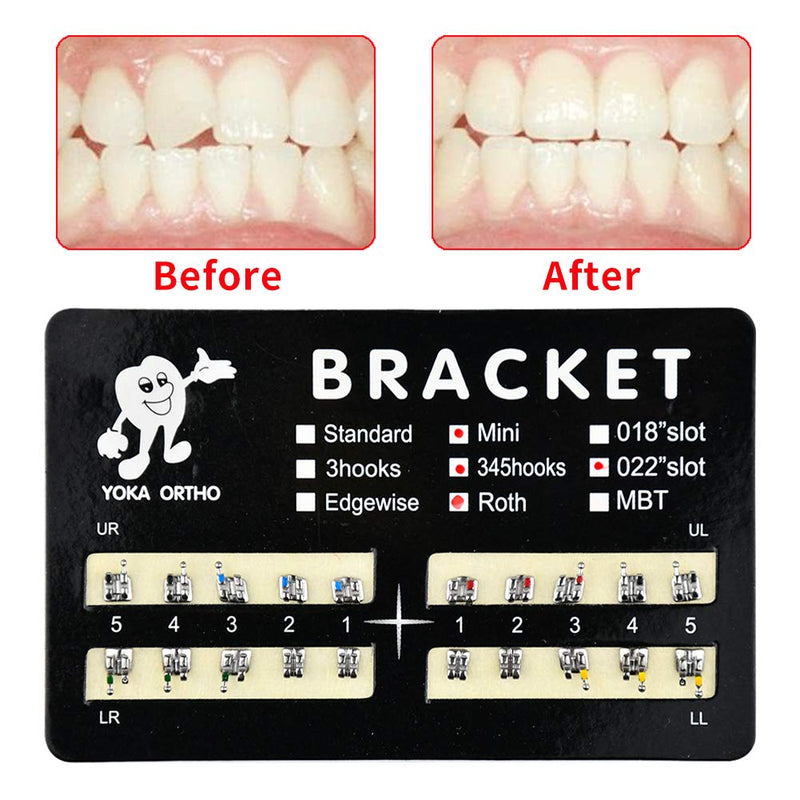 Teeth Model Mini Roth Brackets Roth 022 Slot Bondable with Hook on 347 (200) 200