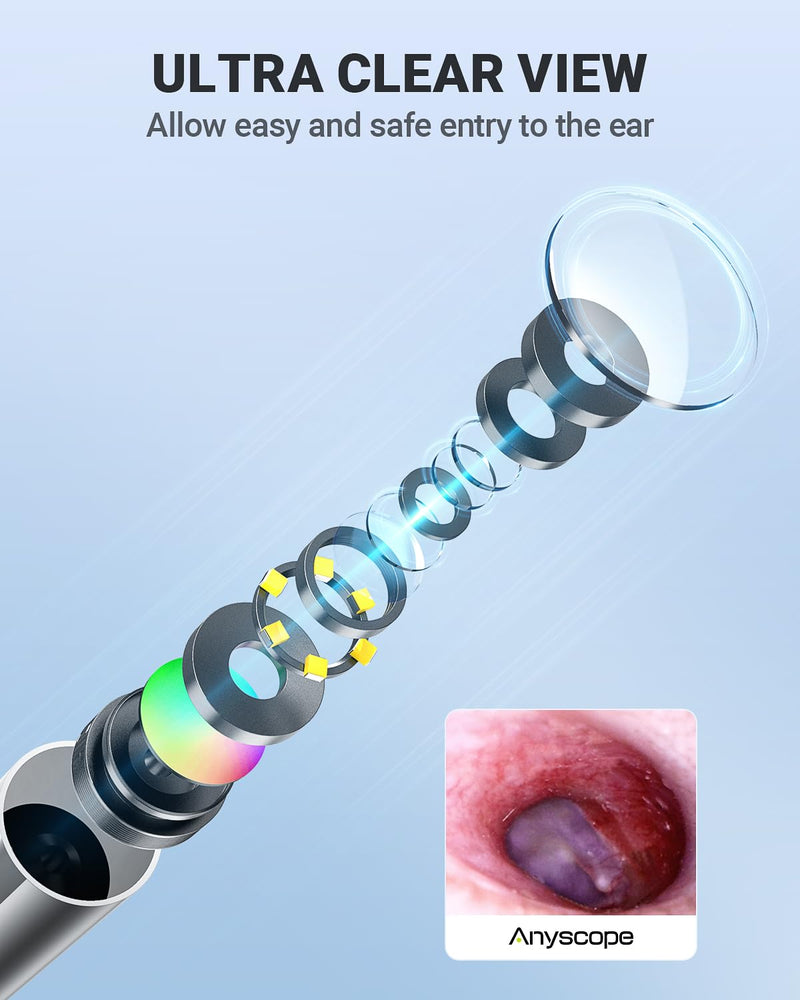 HD Digital Otoscope, Video Ear Scope Otoscope with Light, Ultra Clear View Ear Camera with Ear Wax Removal Tools, Compatible with iPhone and Android Devices (Purple) ﻿ Purple