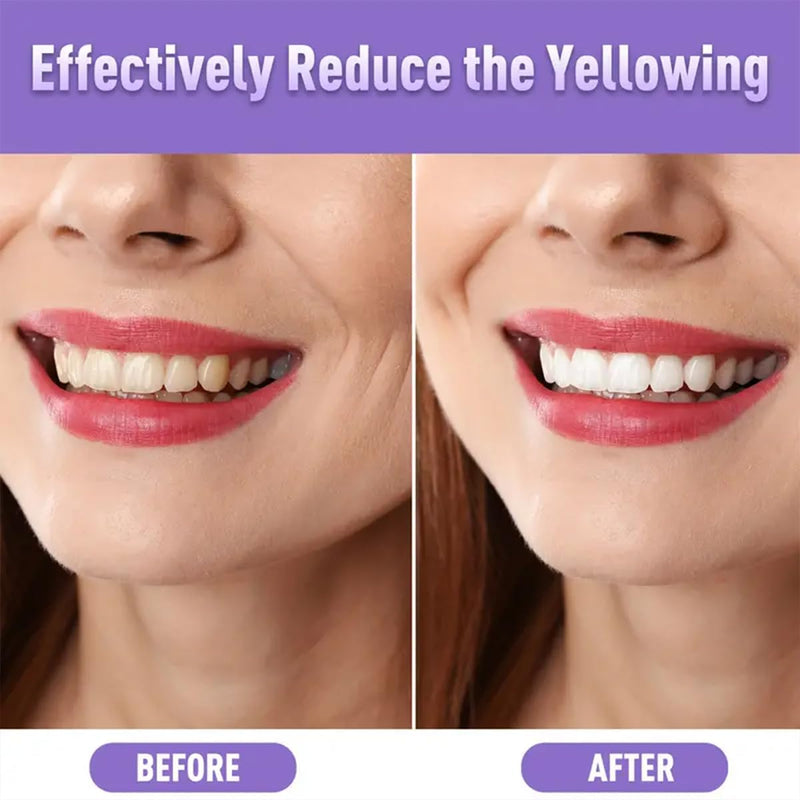 [Australia - AusPower] - NomadNest Teeth Whitening Pen (4 Pcs) - Painless Teeth Whitener, No Sensitivity, Mint Flavor, Travel-Friendly 