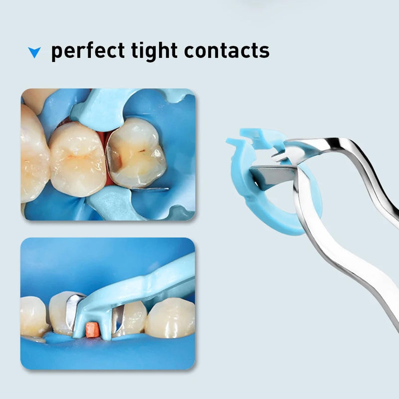 [Australia - AusPower] - 4-Piece Dental Rubber Dam Clamps Set, Hard Resin Material, includes Anterior and Posterior Rubber Barrier Clips, Endodontic Rubber Dam Holders, Autoclavable Dentist Tools for Tooth Isolation Blue 