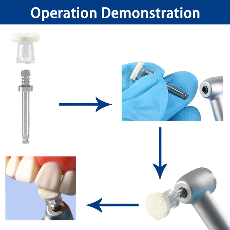 [Australia - AusPower] - Dental Polishing Paste-Impregnated Disc, Dental Polisher Polishing Wheel Felt Finishing Disc with Mandrel for Tooth Polish Dentistry Tool 