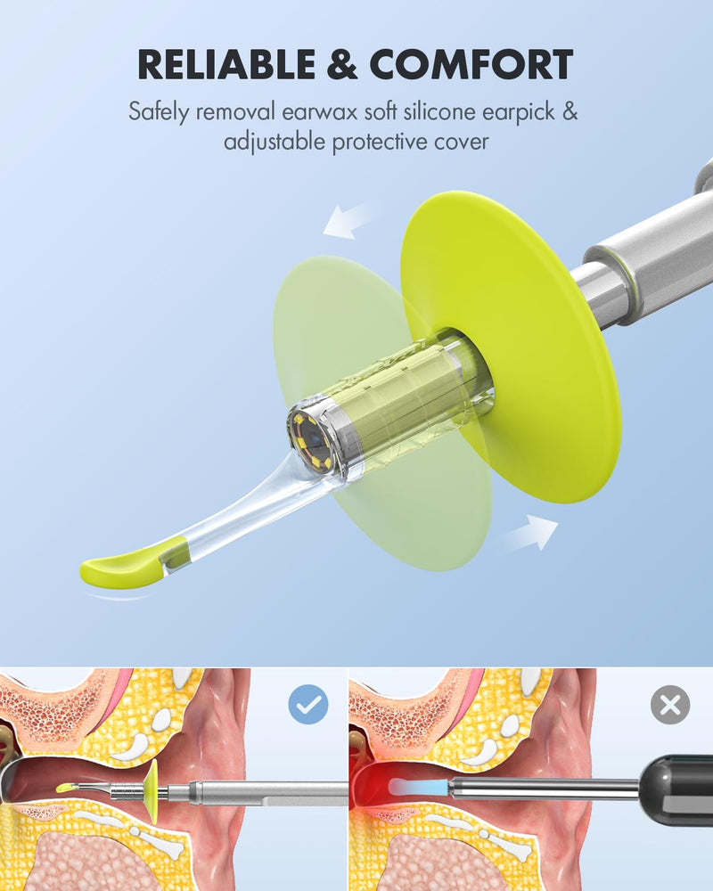 [Australia - AusPower] - Anykit Digital Otoscope for Phone d & Tablet, Ultra Clear View Ear Camera with Ear Wax Removal Tools, Video Ear Scope Otoscope with Light, Support Capture photo & Record Videos Silver 
