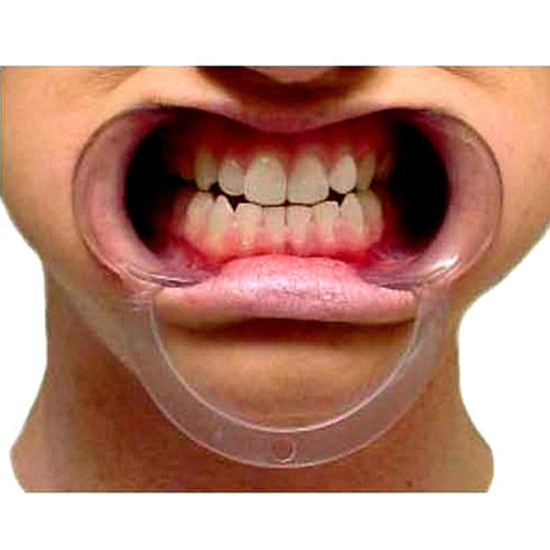 [Australia - AusPower] - 15 pcs Speak Out Dental Cheek Retractor Watch Ya Mouth Game C Adult Kids Teeth Whitening Mouth Opener (S) Small (Pack of 15) 