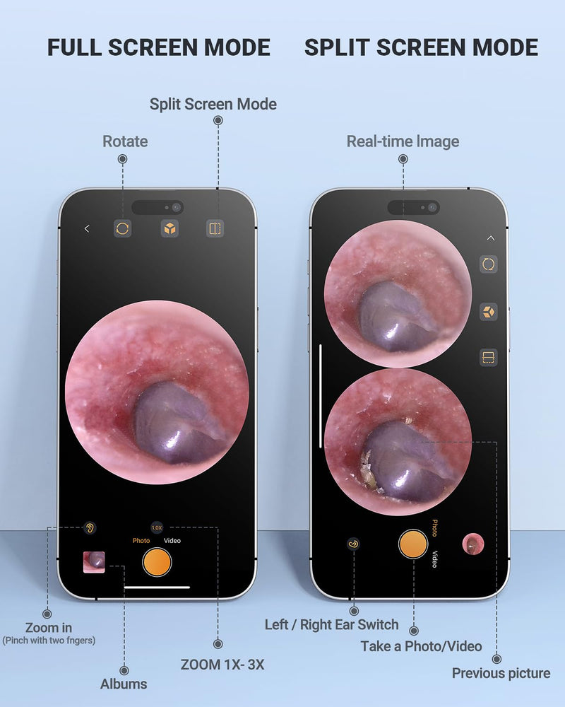 [Australia - AusPower] - Digital Otoscope Compatible with iPhone and Android Devices,AnyScope Ear Specula Set 