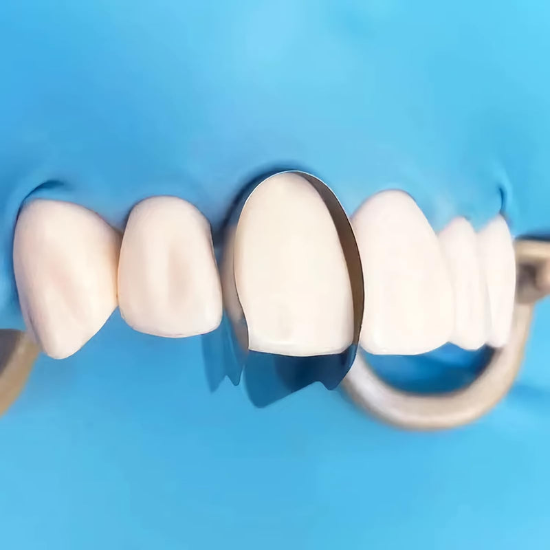 [Australia - AusPower] - 30Pcs/Box Anterior Matrix Bands, Dental Metal Curvature Matrix Bands for Proximal Anterior Restoration Thickness 30?m 