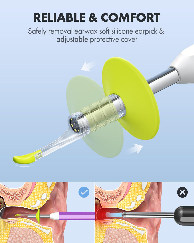 [Australia - AusPower] - Anykit Digital Otoscope with Gyroscope, HD Ultra Clear View Ear Camera with Ear Wax Removal Tools, Video Ear Scope Otoscope with Light, Compatible with Android, iPhone 15 (Purple) 