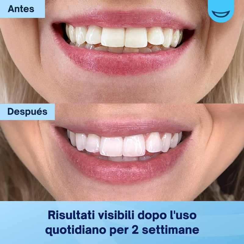 [Australia - AusPower] - MySweetSmile Teeth Whitening Powder - Dentist-Approved & Enamel-Safe | 6 Month Supply | Tea, Coffee, Wine & Smoking Stain Remover | Non-Sensitive Formula | Peroxide Free | Cool Mint Flavour 