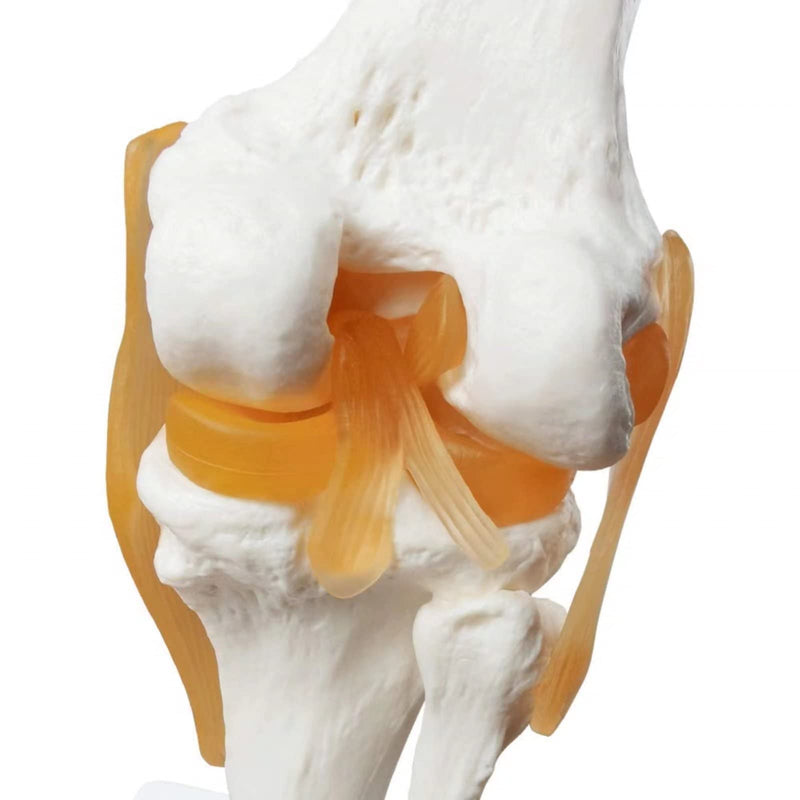 Human Anatomy Knee Joint Model 1:1 with Ligaments / Textbook | EVOTECH SCIENTIFIC Knee Joint Bone Anatomy Model, Suitable for Anatomy Studies, Education and Teaching Purposes Knee With Ligament
