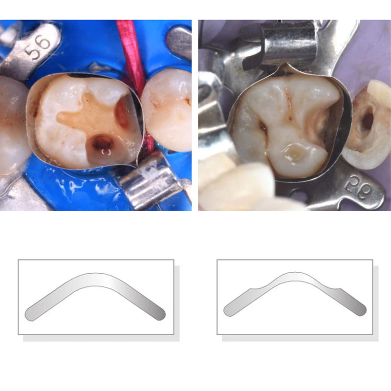 [Australia - AusPower] - Dental Tofflemire Matrix Bands, Dental Matrix Bands, Stainless Steel Matrix Bands, Gingival Wall Lift and Large Curvature Sectional Contoured Matrices. (40PCS I2 Large Curvature) 40PCS I2 Large curvature 