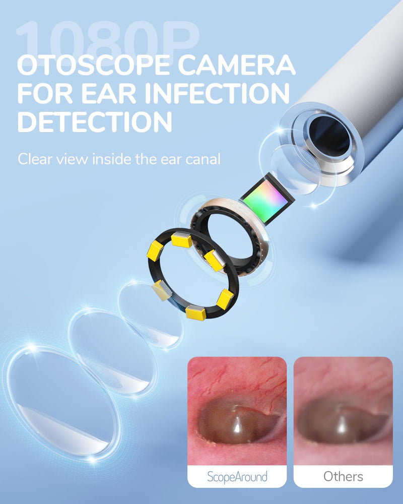 [Australia - AusPower] - ScopeAround Otoscope with Light, Ear Camera with Dual View, 720pHD/1080pFHD WiFi Ear Scope with 6 LED Lights, 3.9mm Lens Otoscope Camera for Kids and Adults, Ear Scope 
