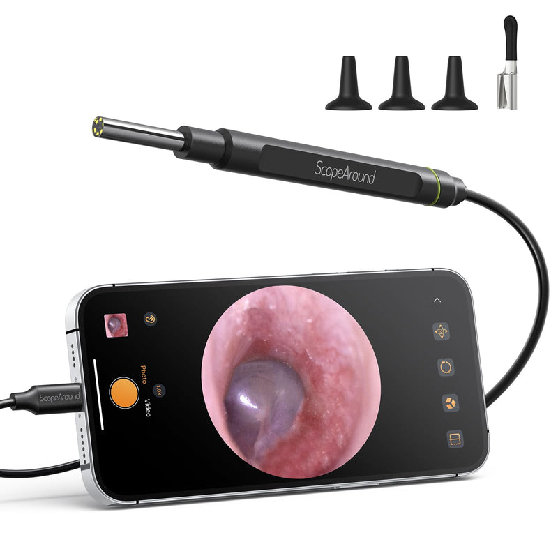 [Australia - AusPower] - ScopeAround Otoscope with Light, Ear Camera with Dual View, 720pHD/1080pFHD WiFi Ear Scope with 6 LED Lights, 3.9mm Lens Otoscope Camera for Kids and Adults, Ear Scope 