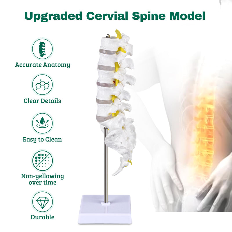 Ultrassist Human Lumbar Spine Model, Lumbar Vertebrae Anatomy Model with Herniation Discs, Lumbar Nerves and Spinal Cord for Medical Student Study Teaching