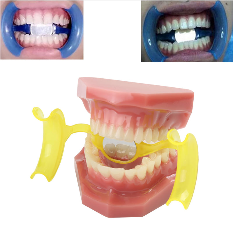 [Australia - AusPower] - Dental Cheek Retractor Mouth Opener M Shape Autoclavable with Mirror for Teeth Whitening Mouthpiece Dentist Tools(10Pcs Yellow) 