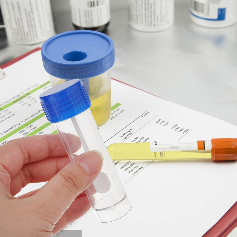 [Australia - AusPower] - Totority Stool Containers Sample, 10 Pcs Specimen Cup with Lid Stool Container 25-30ml Specimen Cup with Spoon Lid Urine Cups for Laboratory Medical Use 