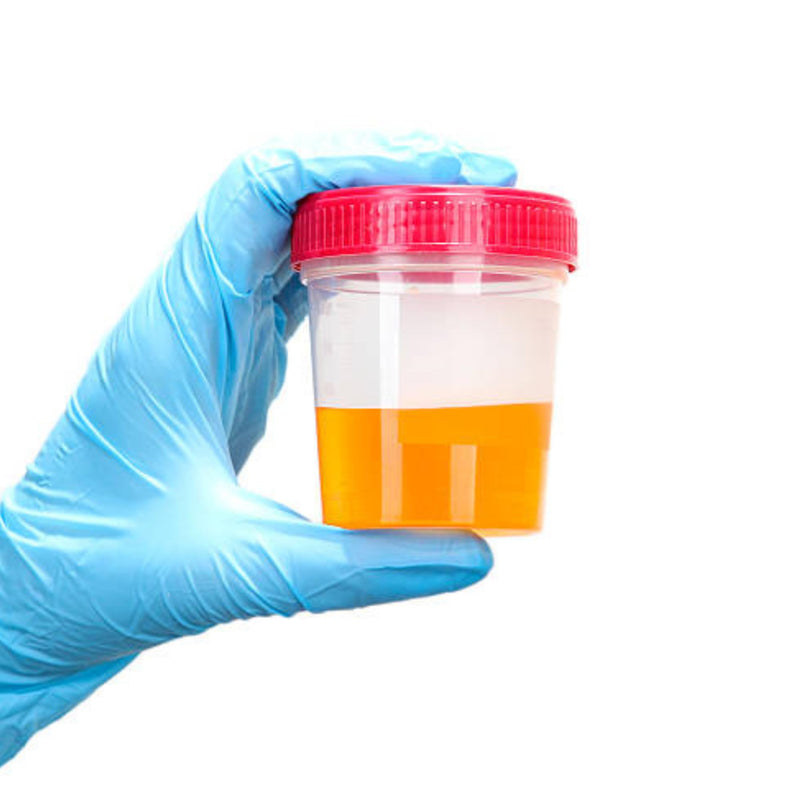 4 Sterile Urine Containers 120 ml with Screw Cap and Label - Urine Cups for Urine Culture Analysis, Hygienic Disposable | 100% Made in Italy