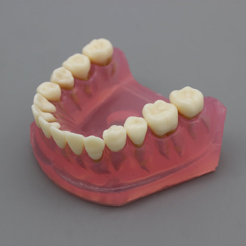 [Australia - AusPower] - Dental Implant Teeth Model Study Teach Standard Model with Removable Teeth 