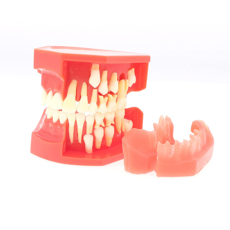 [Australia - AusPower] - Teeth Typodonts Dental Model #7013 - Teeth Eruption Development Model Alternating Model of Constant Pressure of Deciduous Teeth 