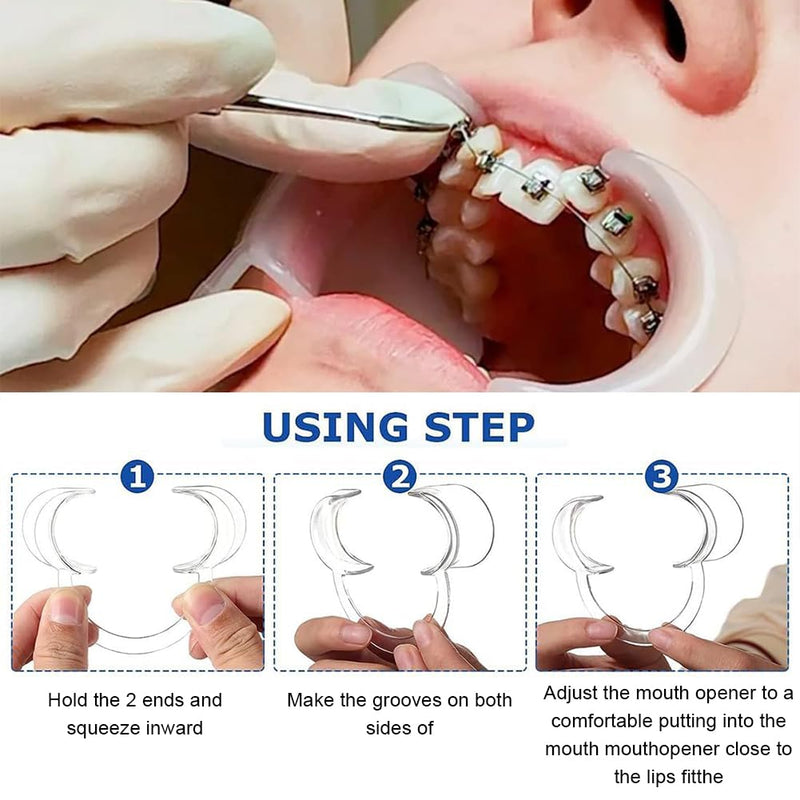 [Australia - AusPower] - 12pcs Mouth Stretcher, C Shape Opener, Mouth Stretcher for Oral Inspection and Teeth Whitening, for Board Games, for Mouth Opener Challenge, Dental C-Shape Mouth Opener for Teeth Whitening 