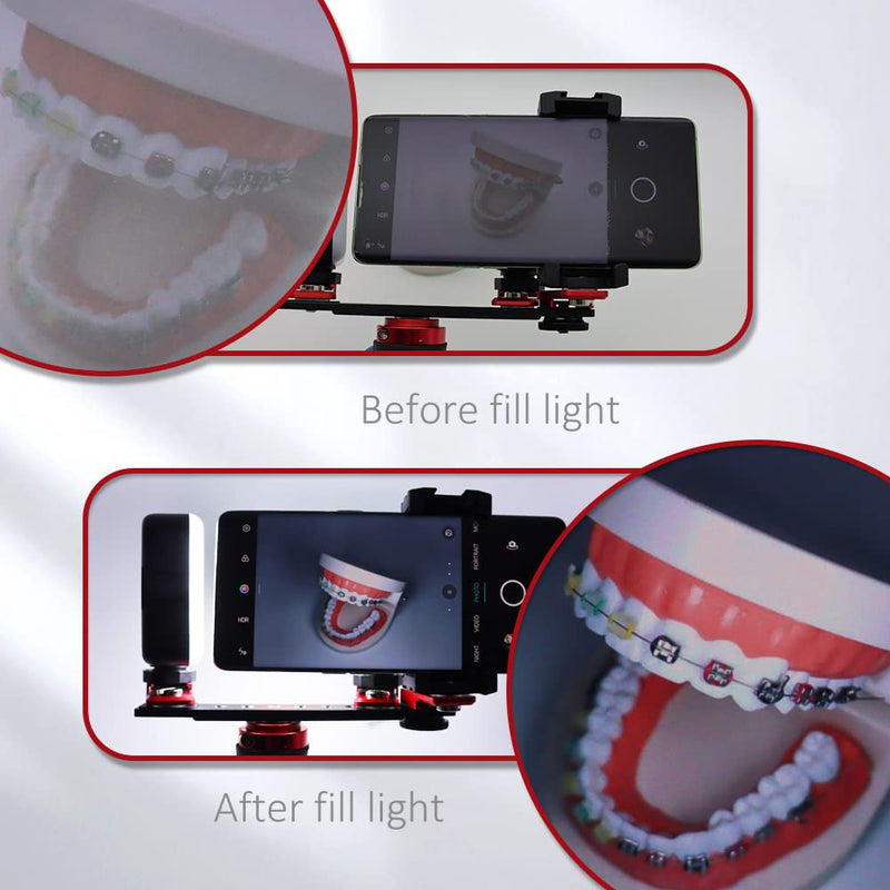 [Australia - AusPower] - Bluetooth Dental Flash Light Photography Equipment Dentistry LED Oral Filling Light for Dentist Lighting Dental Photo Flash light 