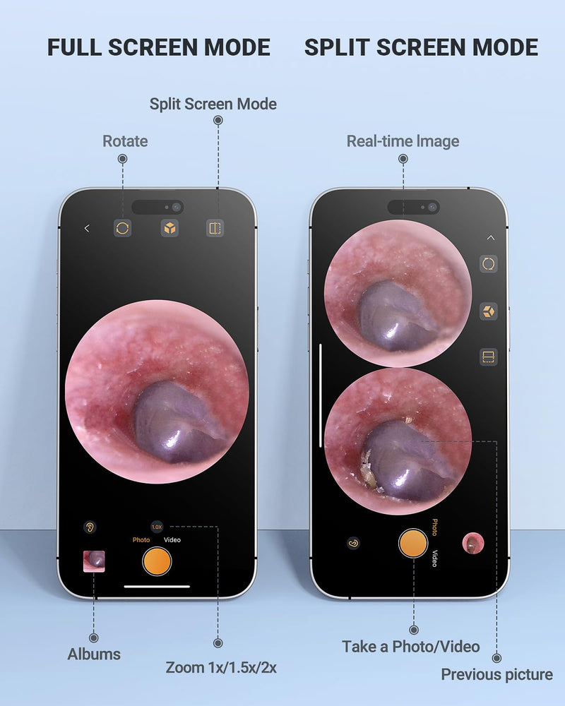 [Australia - AusPower] - Digital Otoscope Compatible with iPhone and Android Devices, HD Ear Camera with Ear Wax Removal Tools, Video Ear Scope Otoscope with Light, Capture Photos and Videos (Silver) Silver 