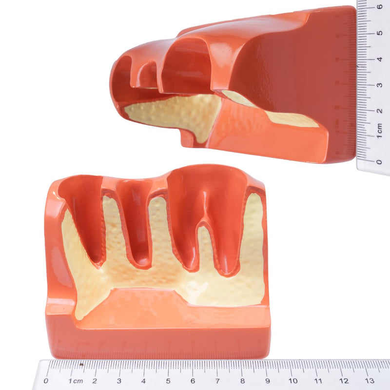 Sarini Oral Dental Model, Dental Implant Model with Removable Crown and Bridge, Suitable for Classroom Demonstrations and Dental Student Training