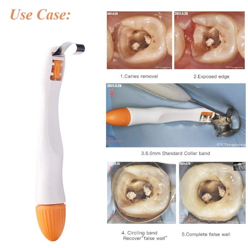 [Australia - AusPower] - Dental Matrix Bands 4.5/6MM Proformed Matrix System Standard/Curved Disposable Matrices Adjustable Metal Matrix Ring (4.5MM Curved 10PCS) 4.5MM Curved 10PCS 