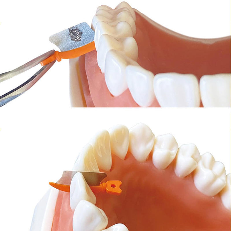 [Australia - AusPower] - Dental Wedge Knife, Dental Interproximal Plastic Wedge, Dental Wedge Guard with Metal, Dental Plastic Wedges Orthodontic Matrix Wedges for Teeth Interproximal Area. (Green S) Green S 